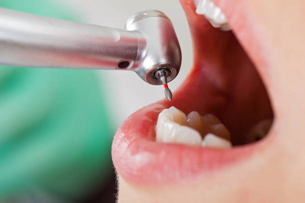 Best Emergency Treatment for Toothache in West Loch Estate, HI
